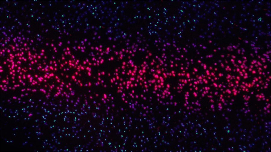 抖音dou+怎么退款